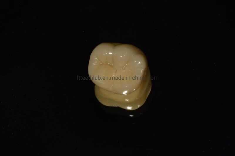 Full Contour Zirconium Bridge Made in China Dental Lab