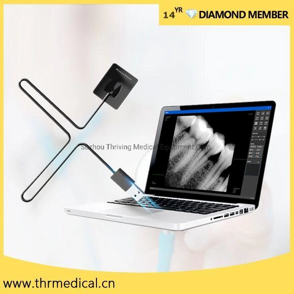 Dental X-ray Sensor Direct Imaging Digital Dental Intraoral Xray Sensor High Efficiency for Use