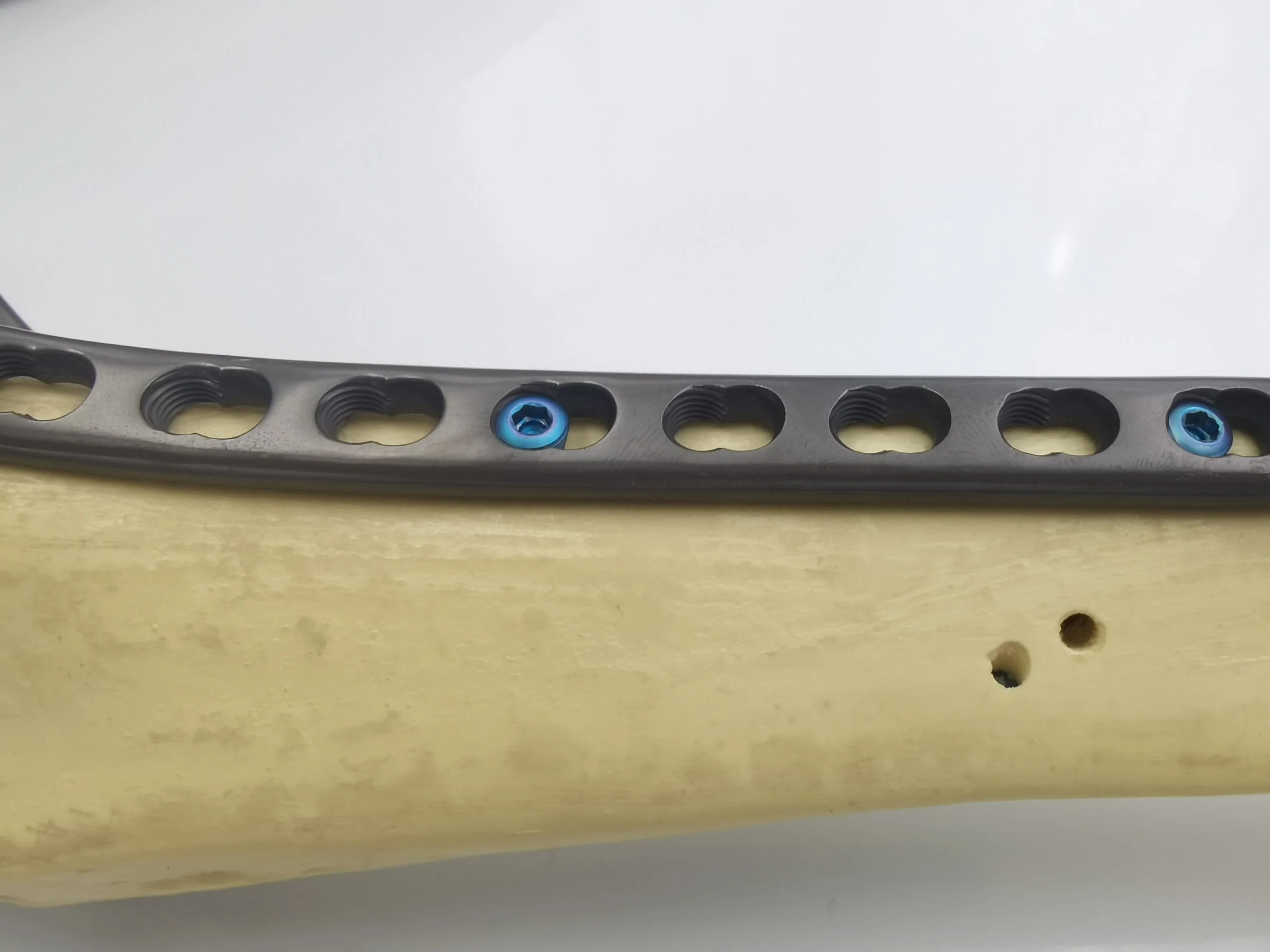 High quality/High cost performance  Orthopedic Lower Limb Implants Titanium Tibial Plateau Medial Locking Plate