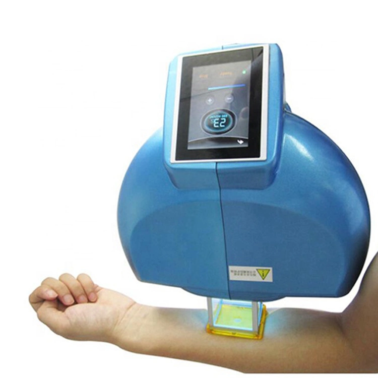 308nm Excimer Laser Vitiligo Treatment 308 Nm Excimer Phototherapy Psoriasis Vitiligo Laser Machine