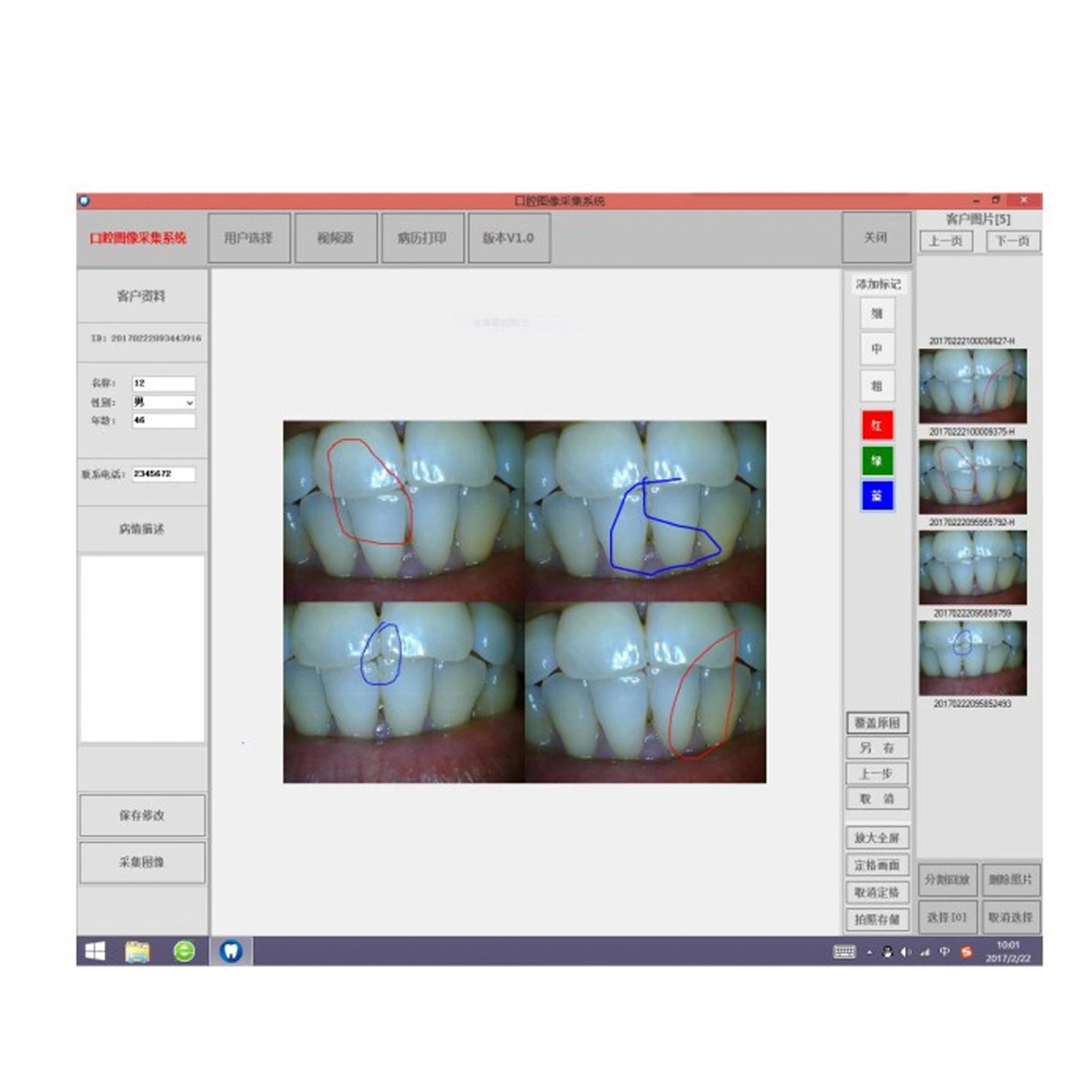 High Grade Intergret Dental Intraoral Camera Monitor Touch Screen