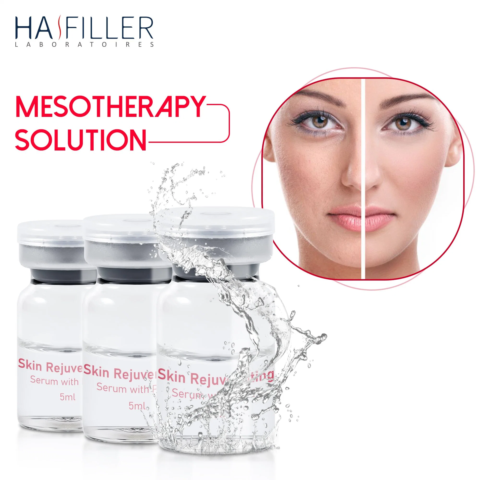 Hot Selling anti Wrinkle peau rajeunissement sérum Pdrn acide hyaluronique Mésothérapie par injection