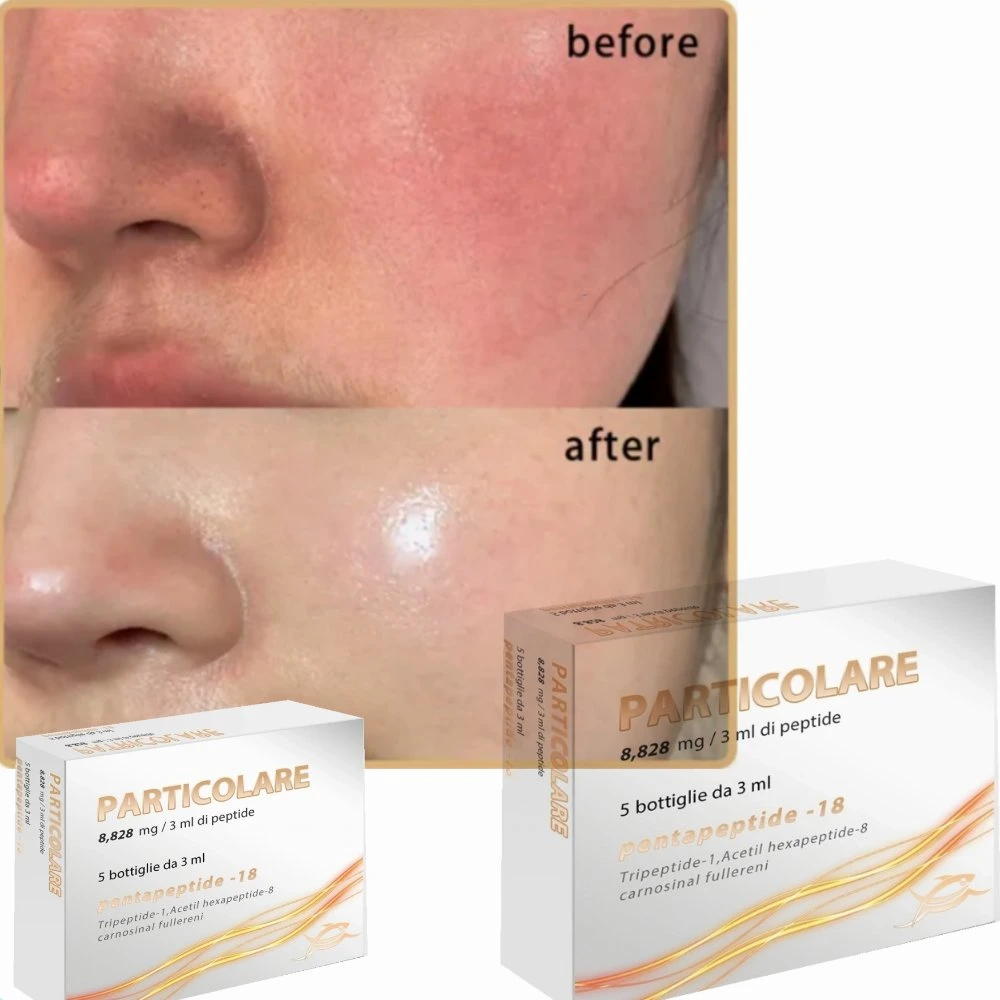 2023 Particolare Pdrn Regen Heal Skin Booster Anti-Aging Polydeoxynucleotide Salmon Anti Wrinkles Factory Price Italian Brand Particolare for Face