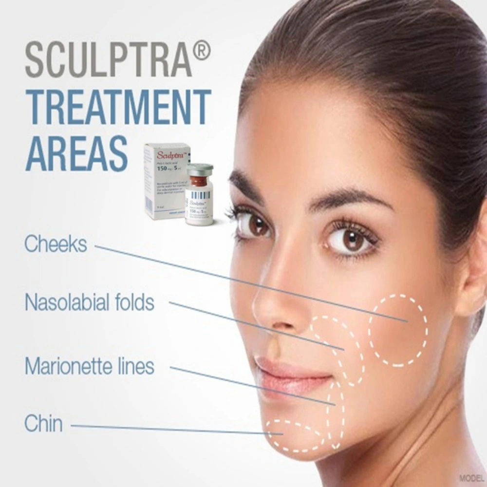 Sculpt Ra PLLA Filler Poly-L-Milchsäure Bio-Stimulator Injectable Dermal Filler Für Gesichtsfüller Buttock Brustvergrößerung