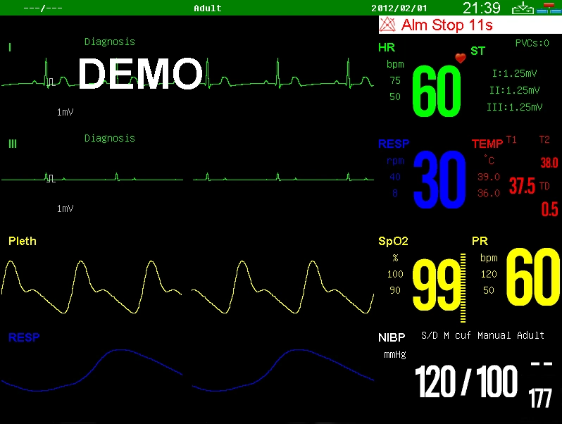 10.4inch Portable Patient Monitor with Suntech NIBP