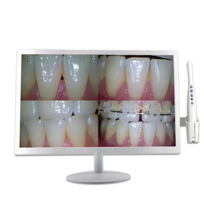 Стоматологическая внутри камеры полости рта с экрана монитора оборудования для клиники
