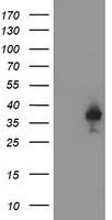 Igfbp2 Monoclonal Antibody