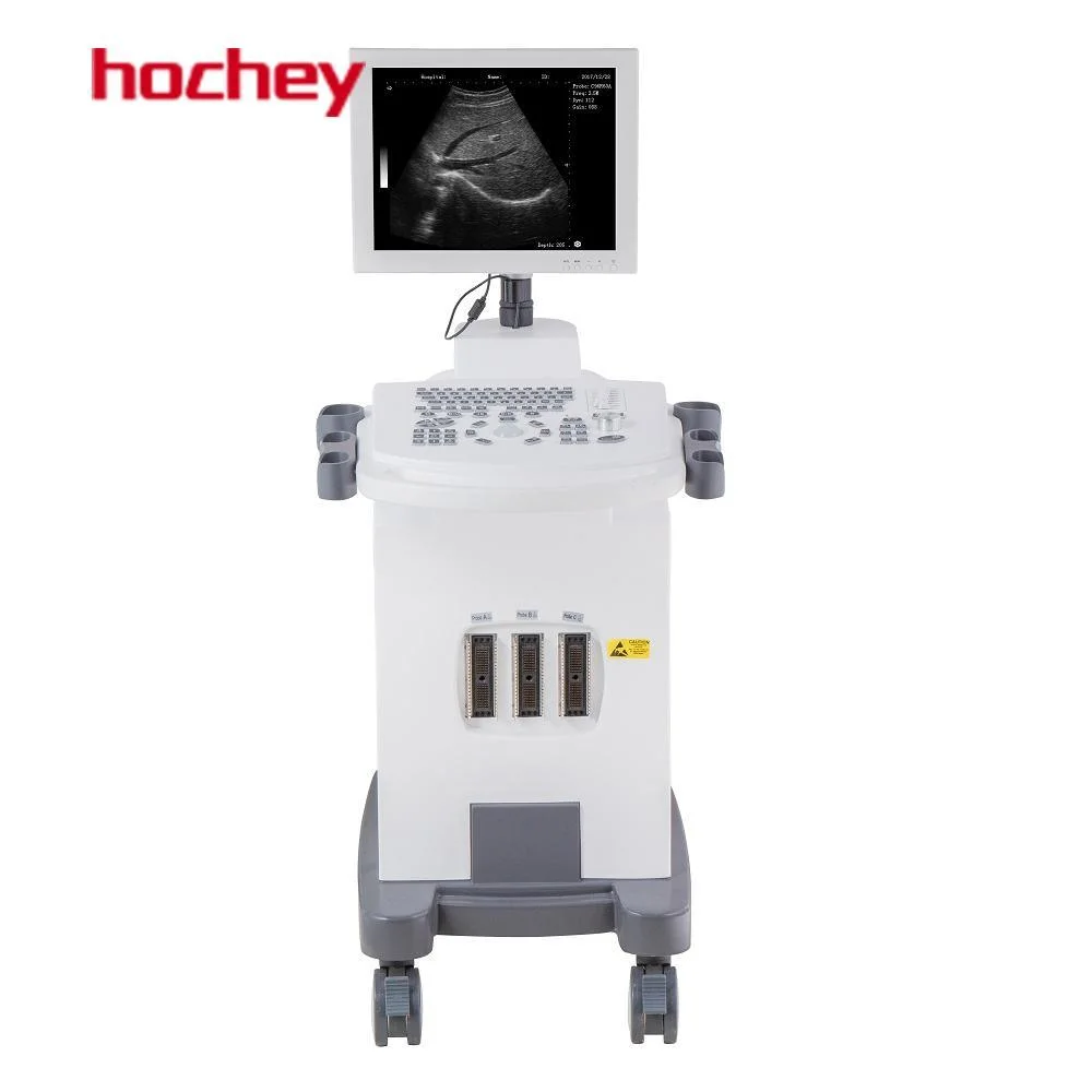 Hochey Medical Portable Luxury New HD Screen 4D Mode Laptop Color Doppler Ultrasound 3 USB Ports Good Equipment