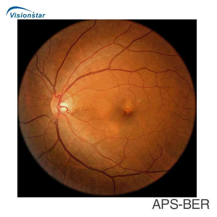 High quality/High cost performance  Auto Focus Automatic Fundus Camera