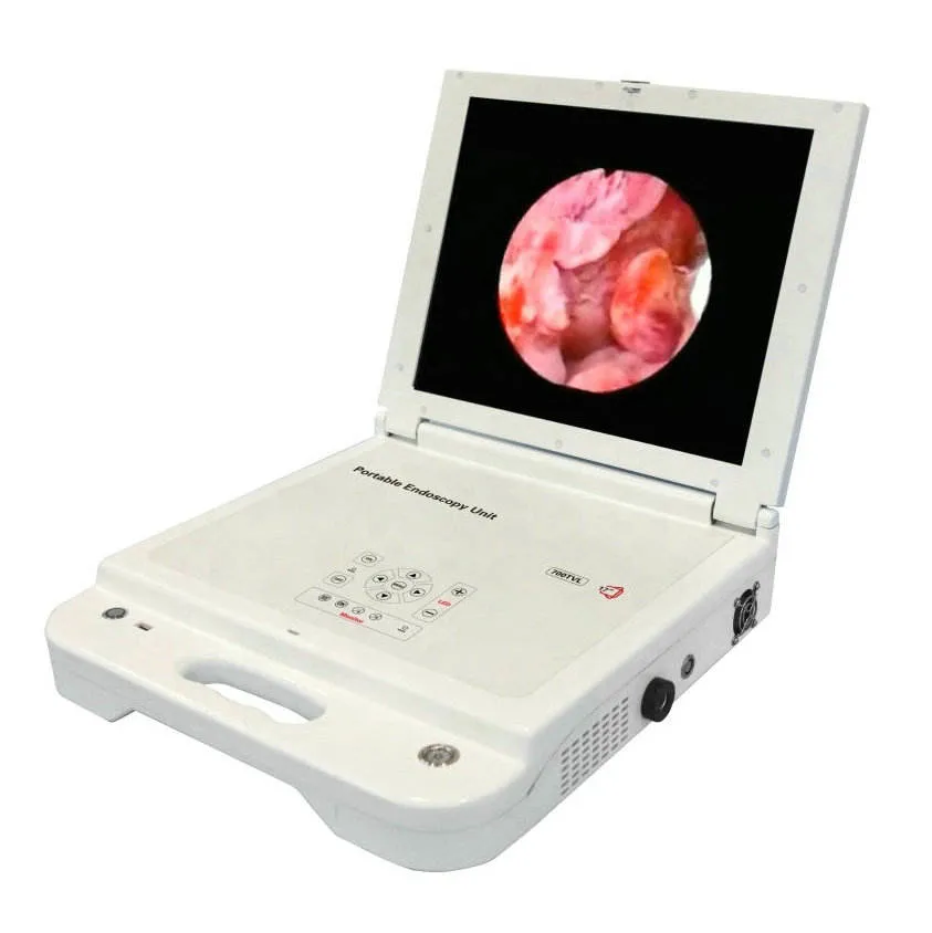 Medical Monitor Diagnostic Ent Machine Arthroscope Endoscopy Camera HD Portable Endoscopy Unit