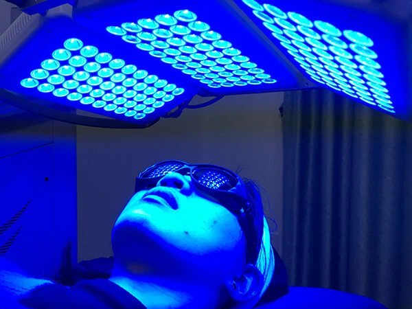 E-Light Therapie Haarentfernung Pigmentierung Behandlung Instrument