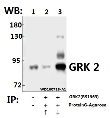 CE, ISO9001 Approved Adrbk1/Grk 2 (D635) Polyclonal Antibody