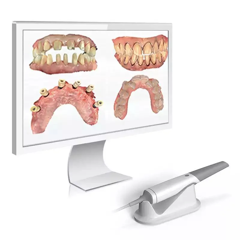 Equipamento de tratamento dentário aparelho de diagnóstico de raios X Handheld 3D Digital Oral scanner