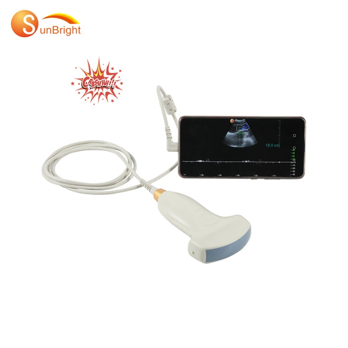 Product USB Ultrasound Probe Portable Ultrasound Machine Device