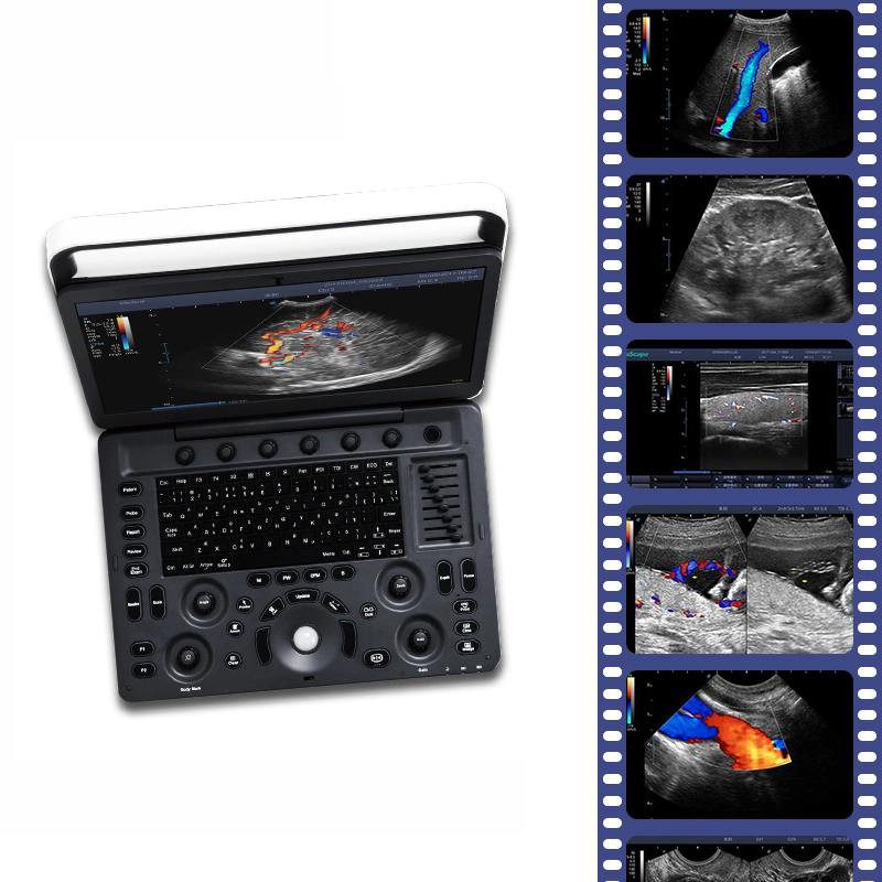 Sonoscape E3 Ultrasound Machine Portable Color Doppler Ultrasound System