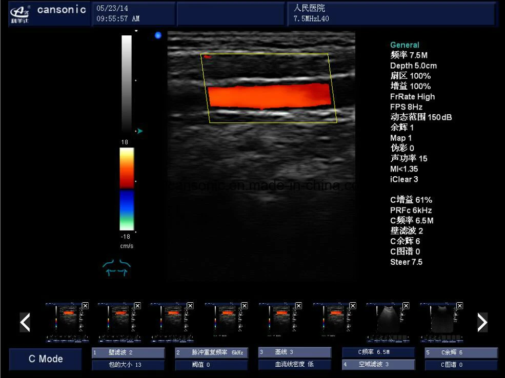 Carrinho para instrumentos médicos 4D Gyn