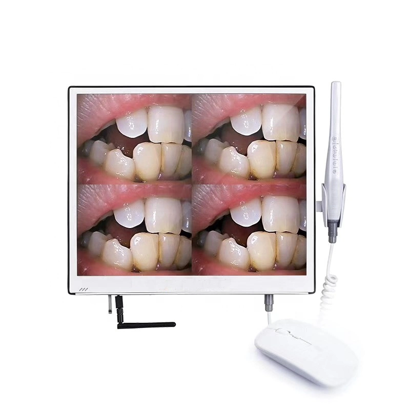 5g WiFi Dental Intra Oral Camera Endoscope System