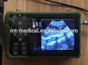 Médico de hochey digital portátil de alta calidad sonda inalámbrica máquina Doppler Ecógrafo veterinario para el animal