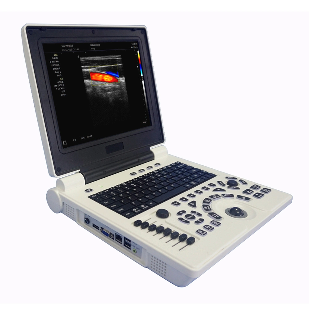 Fábrica Precio Mayorista/Proveedor médico aparato de diagnóstico ultrasónico Equipo portátil lleno Doppler Digital portátil en color