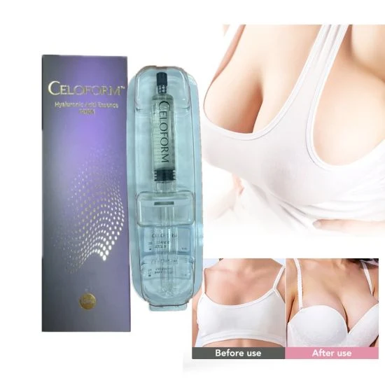 Celoform 10ml Plastic Surgery Implants Best Quality for Breast Buttock Enhance Large Size More Natural Safe Dermal Filler Hyaluronic Acid Gel Beads Max Breast