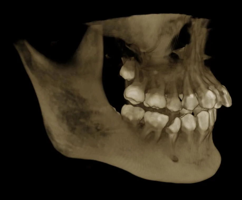 Smart 3D 2D Manufacturer Supplier Digital Panoramic Cephalometric Cbct Dental X-ray Apparatus for Orthodontic Surgery with CE Certificate