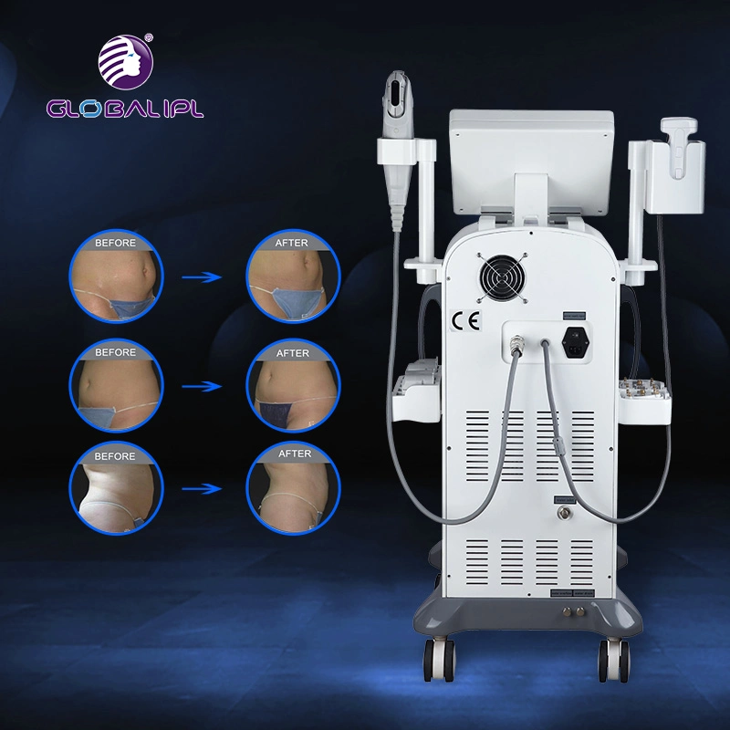 Máquina Liposonix Hifu para adelgazar el rostro, anti-envejecimiento, reducción de grasa corporal y eliminación de celulitis