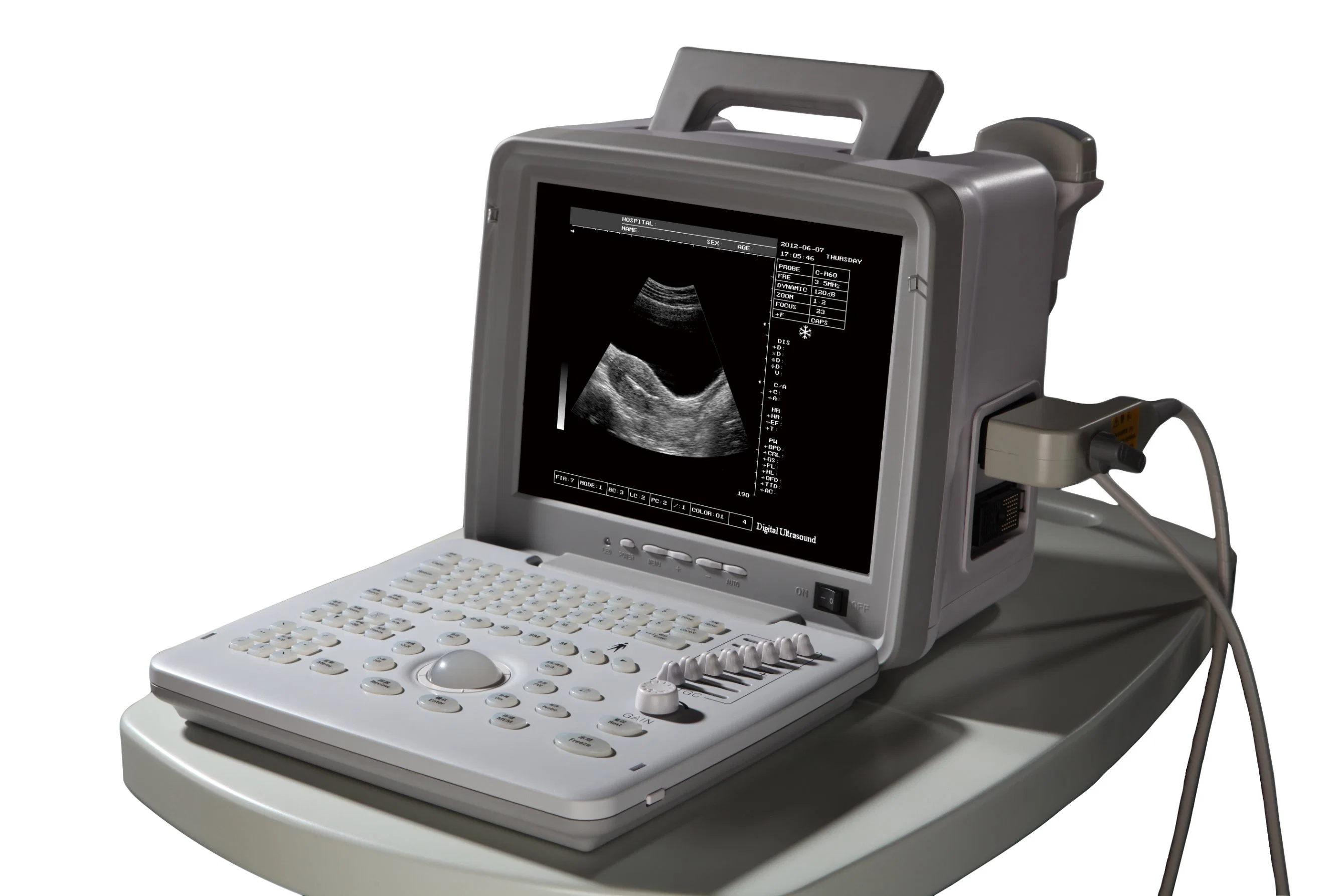 Handeld Black and White Portable Ultrasound Scanner for Convex Probe