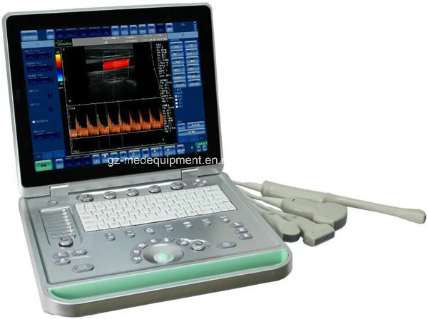 Color Doppler Medical Equipment 2D 3D 4D Portable Ultrasound Scanner (7 Models for your Choice)