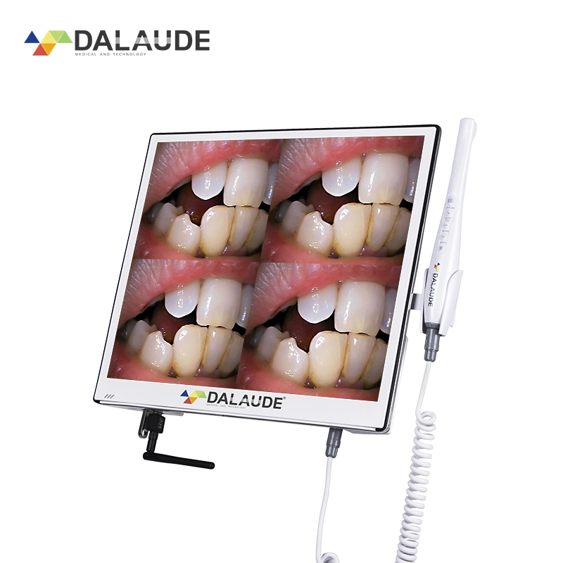 New 2022 Dental Equipment Digital Camera Intra Oral Viewer with Player