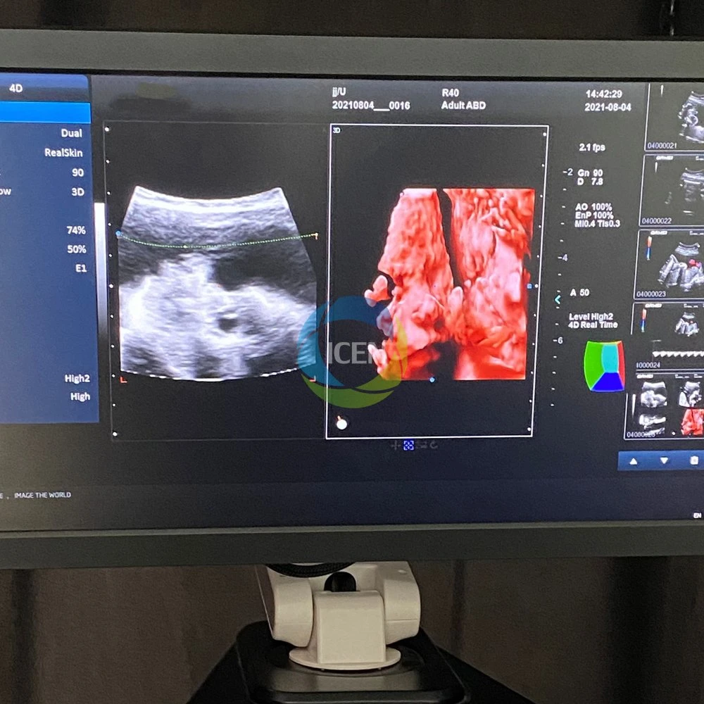 In-AT5 PRO digital 3D 4D 5D color Doppler b رخيص الأبعاد ماسح طبي بالموجات فوق الصوتية