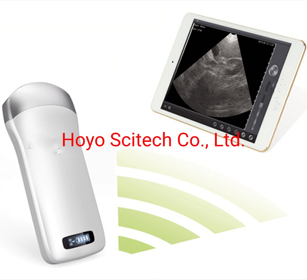 Animal Doppler Ultrasound Diagnostic Apparatus Portable Doppler Ultrasound