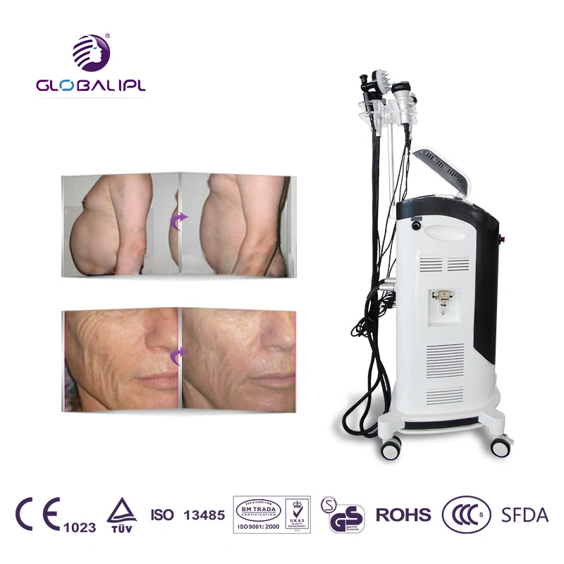 Hot Sale Liposuction Ultrasonic Cavitation Slimming Machine