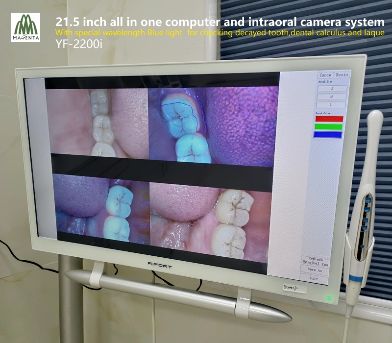 Configuração de alta 21,5" de tela sensível ao toque Windows 10 e Oral Dentária Unidade de câmara com luz azul para dentes cariados/cálculo matemático e placas