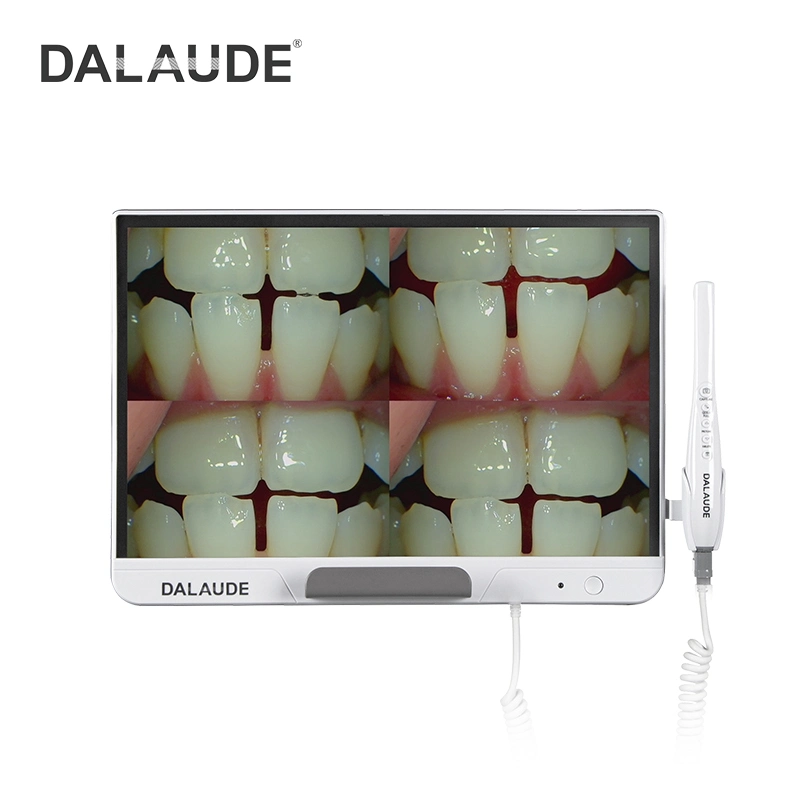 Функция передачи изображения и видео стоматологических устные эндоскопа с большим дисплеем