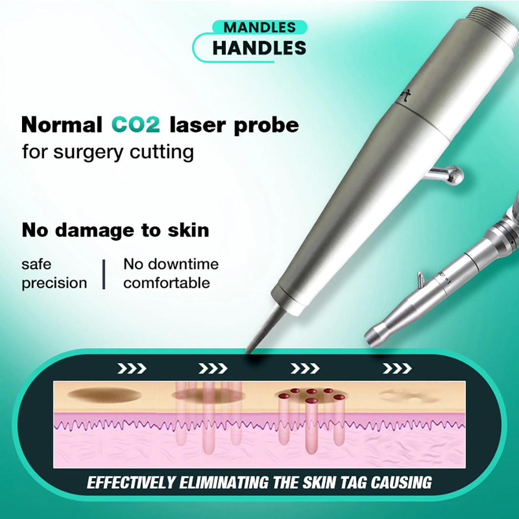 CE/FDA/CO2 RoHS фракционной лазерной влагалище омоложения угри обращения