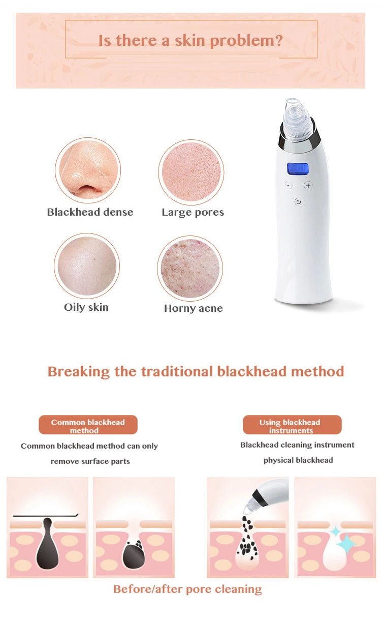 Extractor eléctrico USB portátil de Blackhead Pore instrumento de belleza de vacío