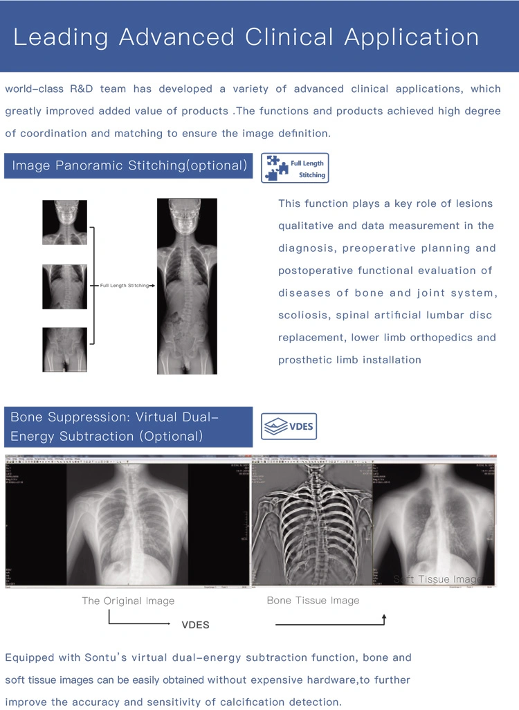 معدات الأشعة XRay 3.5 كيلو واط جهاز الأشعة السينية المتنقل عالي التردد راي ميديكال