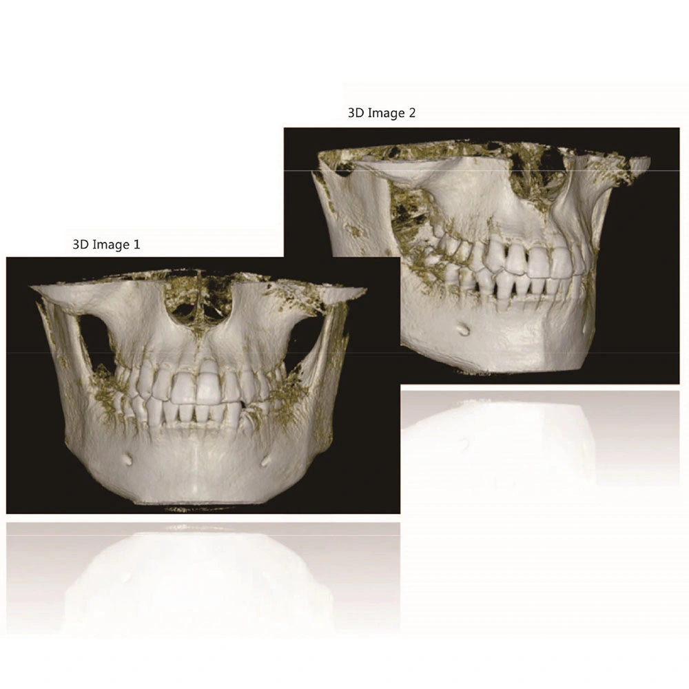 H-X9010d PRO 3D Cbct Machine de numérisation panoramique dentaire par rayons X