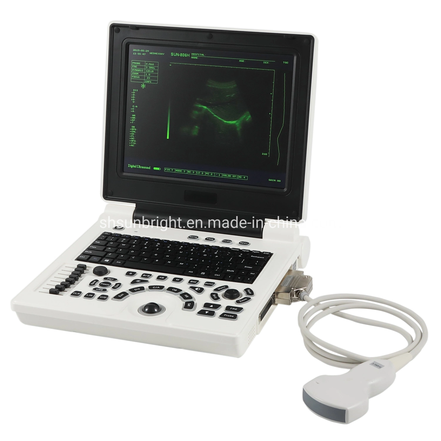 Clinic Hospital Cheapest Ultrasound Scanner Veterinary Portable for Pregnancy Animals