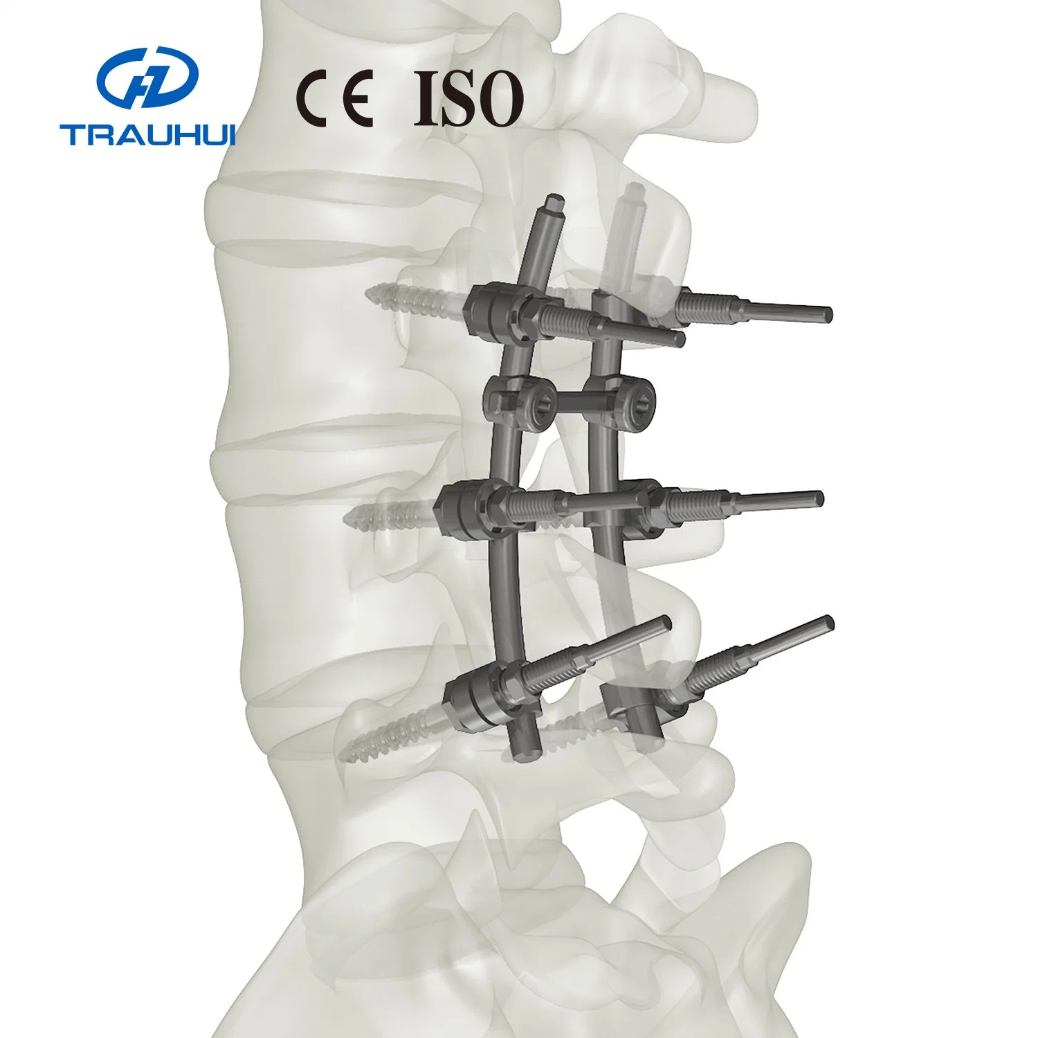 Jeu de fixation cervicale postérieure Instrument