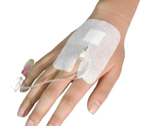 Fixação do cateter intravenoso de bandagem, Non-Woven ou PU material, com uma almofada de absorção de umidade com cateter intravenoso Cortes Wing IV Penteadeira Curativo