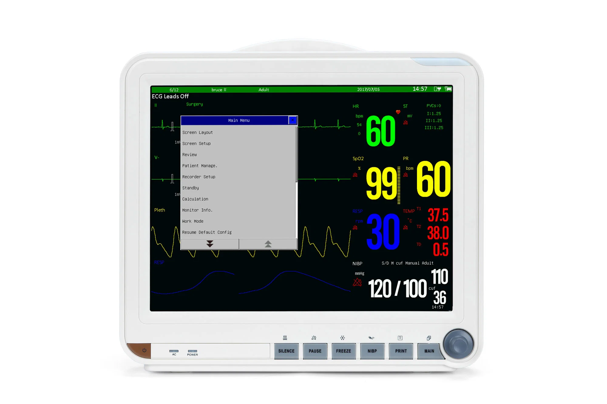 Sinnor Snp9000I 15-Inch Medical 6 Parameter Semi Modular Patient Monitor for ICU Factory Directly