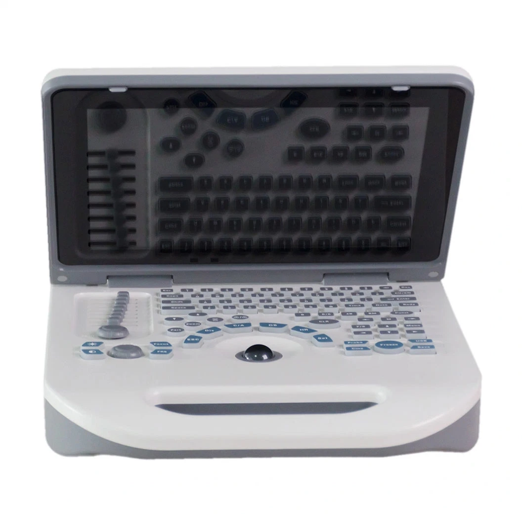 Hot Sale Portable 2D Digital Ultrasound Echo Scanner for Abdomen