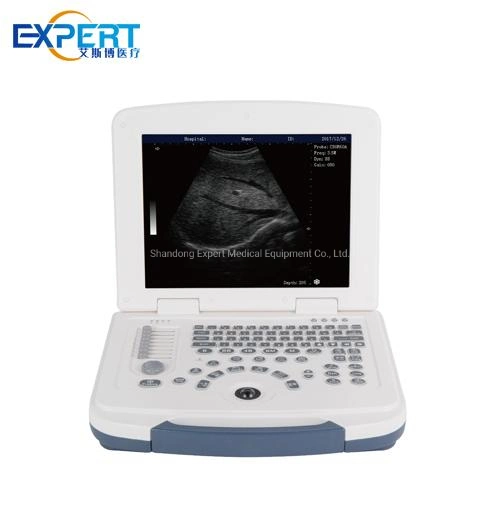 Veterinarian Black and White Super B Scan Ophthalmic Digital Ultrasound Low Price Medical High Intensity Focused Equipment