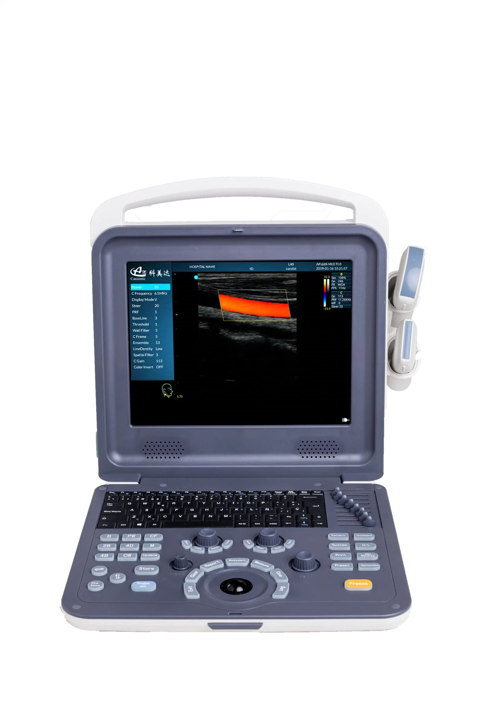 Portable Color Doppler Ultrasound Scanner for Female K0