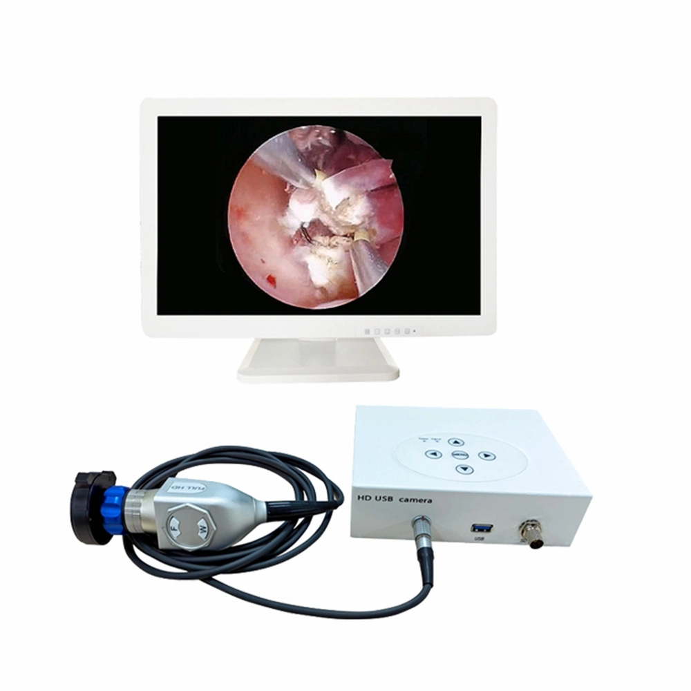 Portable Endoscope USB Camera for Ent Urology Athroscope Rigid Endoscopy