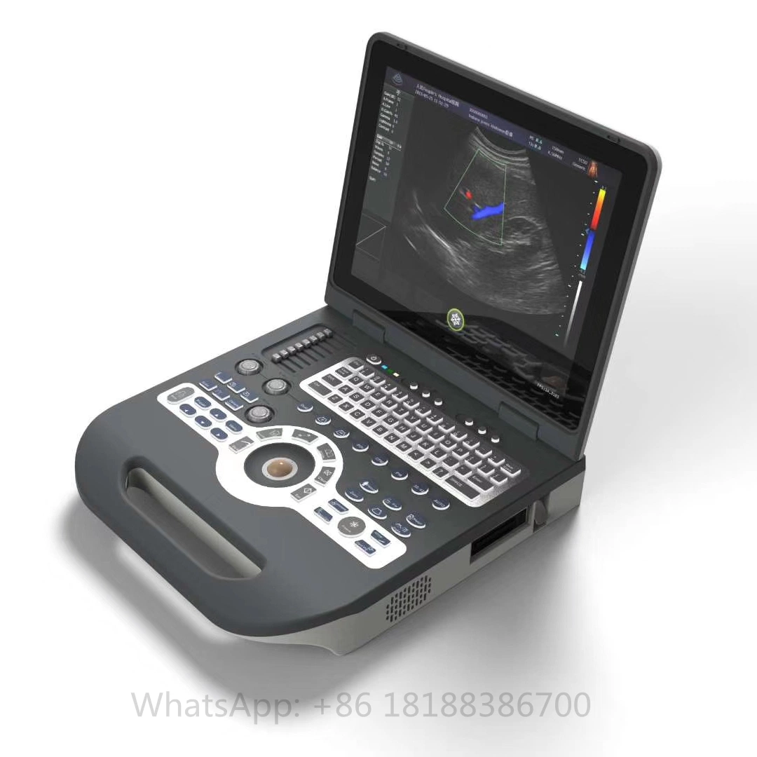 Ordinateur portable portable Échographie 3D'Imagerie Doppler couleur économique du système de diagnostic