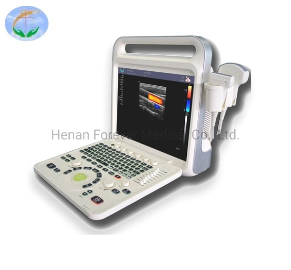 High End Laptop Color Doppler Ultrasound Diagnostic System with Low Price