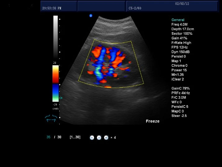 China Doppler portátil 2D 15 Polegadas visor da máquina de sonografia ultra-som portátil