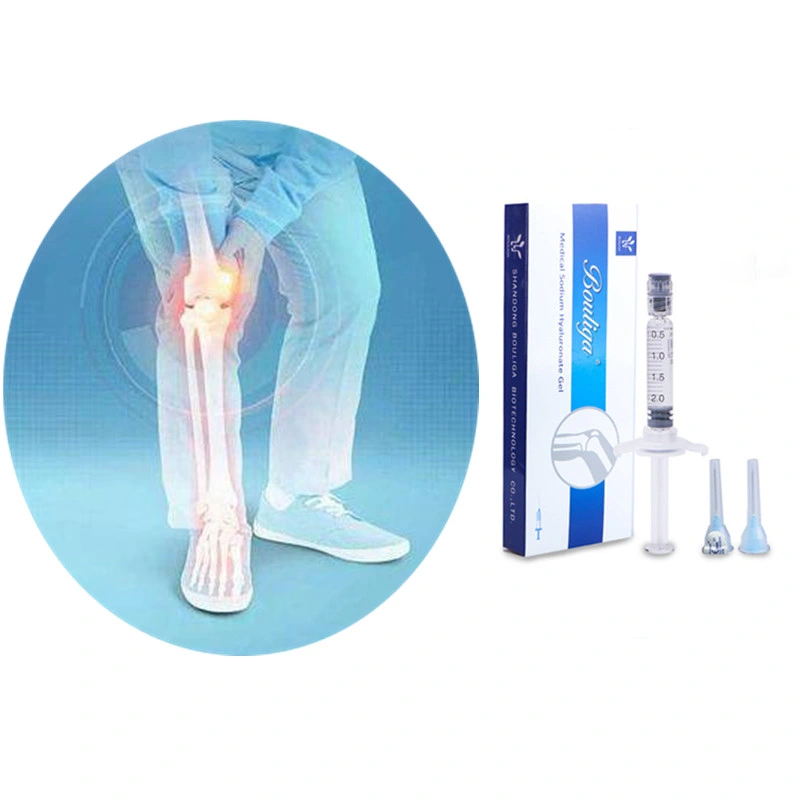 Ácido Hialurónico rodilla intraarticular Osteoartritis Inyección articular Llenador dérmico